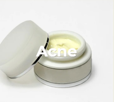 Acne